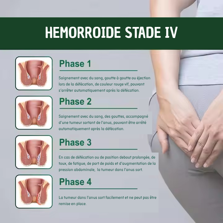 HEMORRHOID CREAM