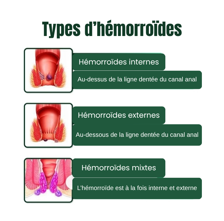 HEMORRHOID CREAM