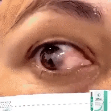 ROULEAU VISION - SOIN DES YEUX