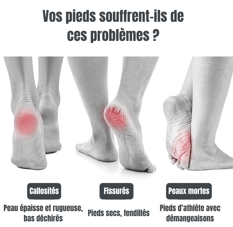 Pieds Doux Sans Effort – Lime Électrique Professionnelle Anti-Peaux Mortes